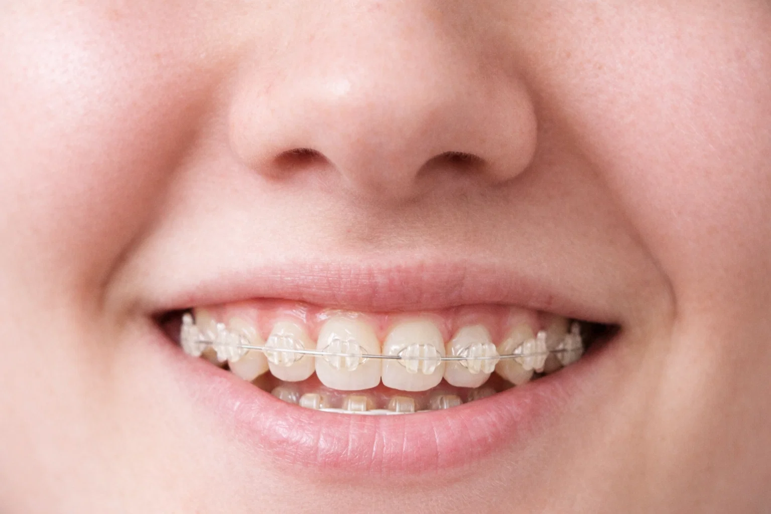 정교한 IPR 과정